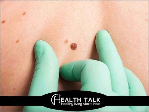 Early Signs of Cancer